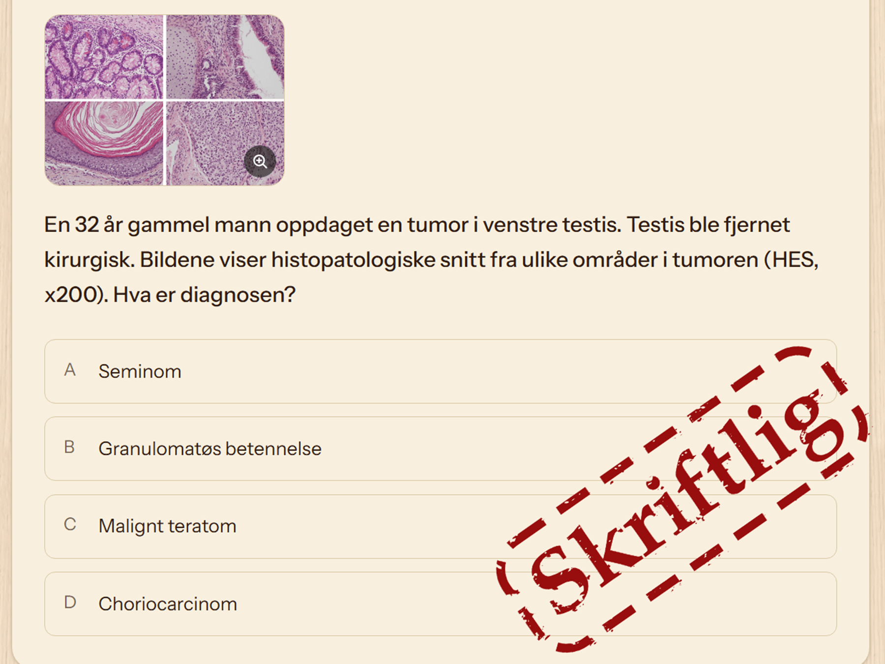 Et spørsmål om en testikkeltumor med fire histopatologiske snitt øverst og et forstørrelsesikon over bildene.