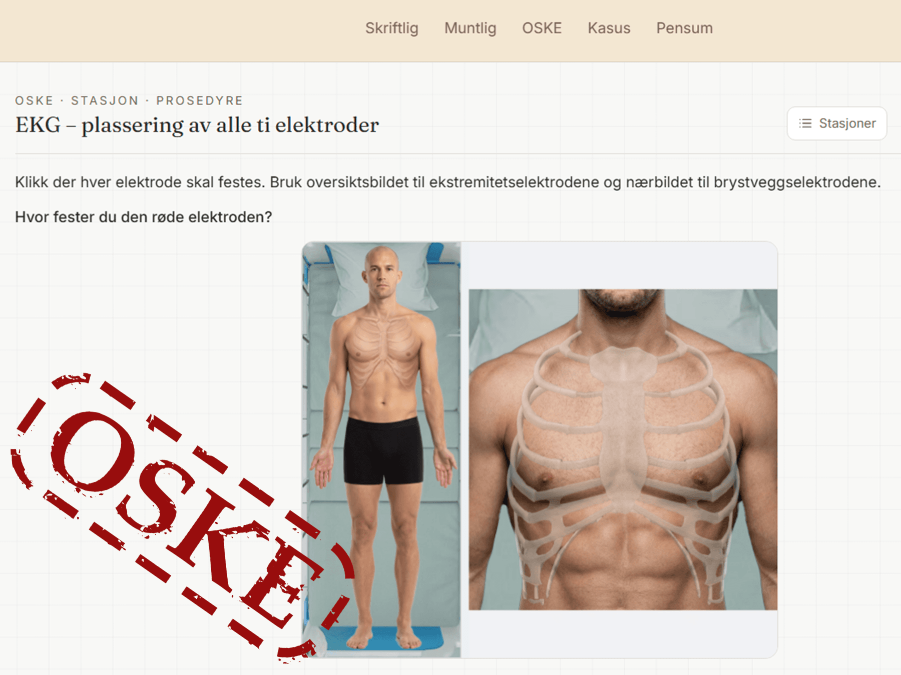 En prosedyrestasjon der ti EKG-elektroder skal plasseres, med et helkroppsbilde og et nærbilde av brystveggen.